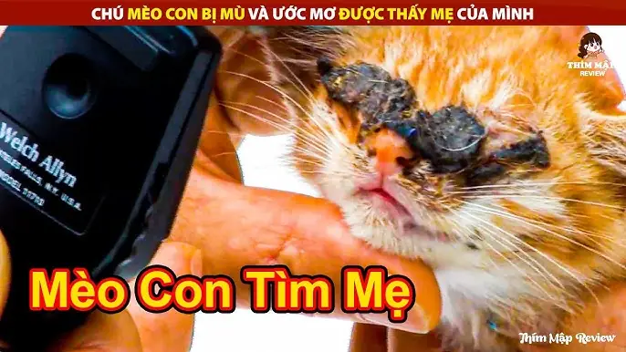 Giải Mã Ý Nghĩa Giấc Mơ Thấy Mình Bị Mù Mắt: Điềm Báo Và Con Số May Mắn