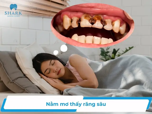 Nằm Mơ Thấy Mình Tự Nhổ Răng Đánh Con Gì? Giải Mã Chi Tiết Từ Tâm Linh Đến Khoa Học