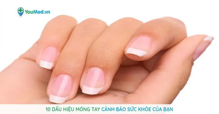 Giải Mã Chi Tiết Ý Nghĩa Khi Nằm Mơ Thấy Móng Tay Bị Hư: Điềm Báo Gì?