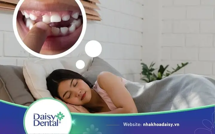 Nằm Mơ Thấy Nhổ Răng Đánh Con Gì? Giải Mã Chi Tiết Từ Tâm Lý Đến Vận May