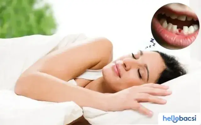 Nằm Mơ Thấy Rụng Hết 2 Hàm Răng: Giải Mã Ý Nghĩa Đằng Sau Giấc Mơ Bí Ẩn