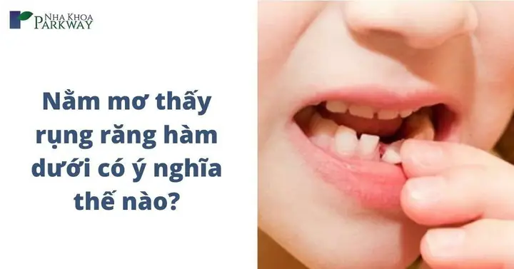 Nằm Mơ Thấy Rụng Hết 2 Hàm Răng: Giải Mã Ý Nghĩa Đằng Sau Giấc Mơ Bí Ẩn