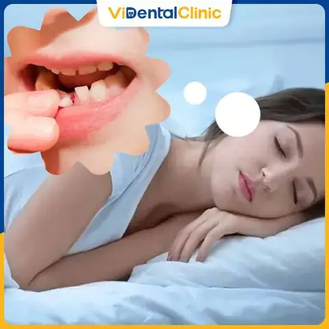 Giải Mã Giấc Mơ Thấy Rụng Răng: Ý Nghĩa Tâm Lý, Điềm Báo & Con Số May Mắn