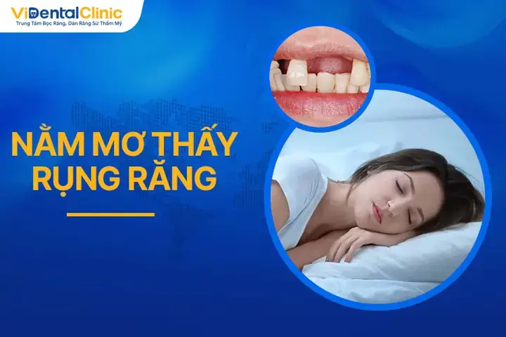 Giải Mã Giấc Mơ Thấy Rụng Răng: Ý Nghĩa Tâm Lý, Điềm Báo & Con Số May Mắn