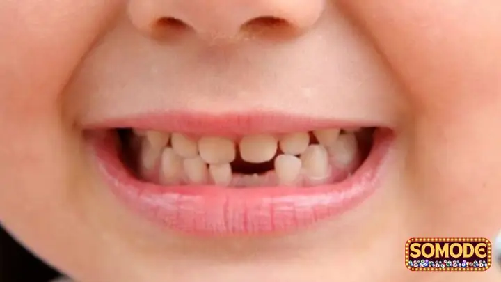 Giải Mã Ý Nghĩa & Con Số May Mắn Khi Nằm Mơ Thấy Rụng Răng Không Chảy Máu