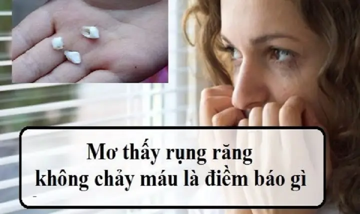 Giải Mã Giấc Mơ: Nằm Mơ Thấy Rụng Răng Không Chảy Máu Báo Hiệu Điều Gì?