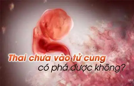 Sẩy Thai Khi Chưa Có Tim Thai Có Cúng Không? Giải Đáp Chi Tiết Từ Văn Hóa Đến Khoa Học