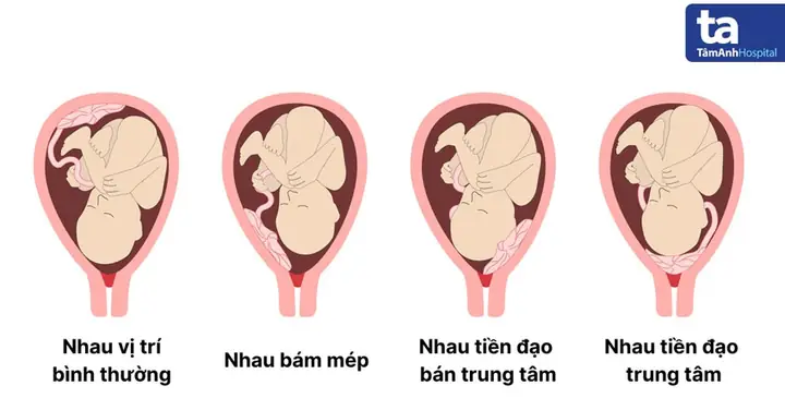 Ý Nghĩa Và Nguồn Gốc Của Việc Thấy Cúng Dao Tiền Thanh La