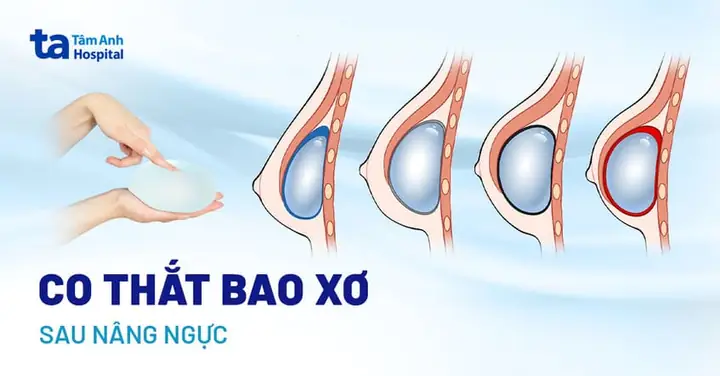 Thề Cúng Năm Cô Là Gì? Nguồn Gốc, Ý Nghĩa Và Những Điều Cần Biết