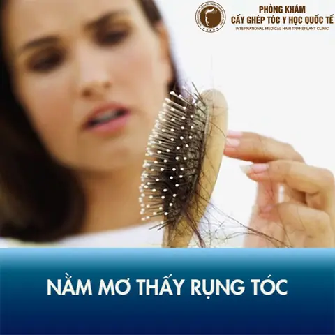 Giải Mã Ý Nghĩa Giấc Mơ Bị Hói Đầu: Từ Góc Nhìn Khoa Học Đến Tâm Linh
