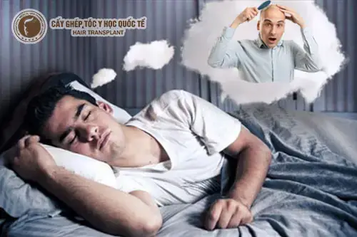 Giải Mã Ý Nghĩa Giấc Mơ Bị Hói Đầu: Từ Góc Nhìn Khoa Học Đến Tâm Linh