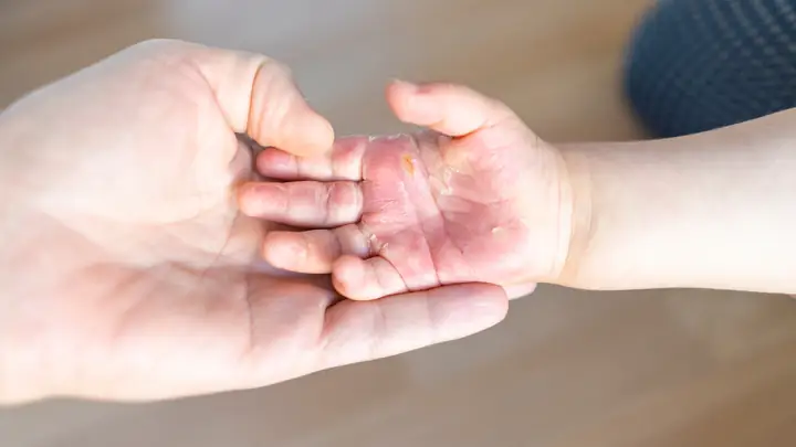 Ý Nghĩa Giấc Mơ Thấy T Cùng Rộm