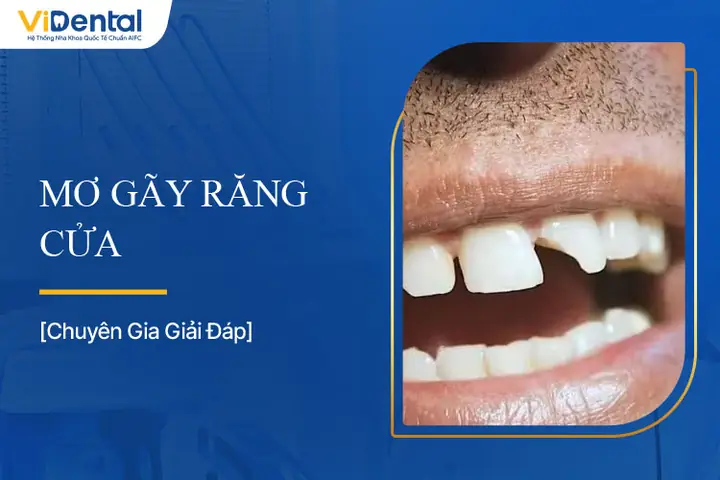 Giấc Mơ Thấy Gãy Răng Cửa Trên: Ý Nghĩa Chi Tiết Và Cách Xử Lý