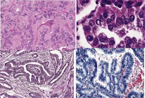 Mơ Thấy Mình Bị Đánh Ghen Là Gì? Giải Mã Từ Dân Gian Đến Tâm Lý