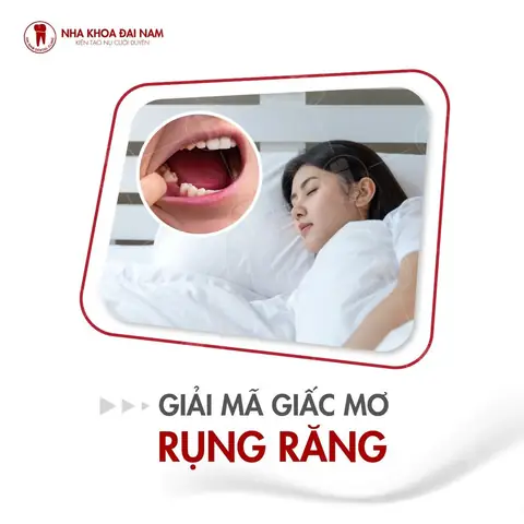 Nằm Mơ Thấy Bị Đau Răng: Ý Nghĩa Và Những Điều Cần Biết
