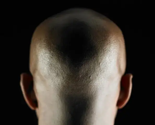 Giấc Mơ Thấy Đầu Người Chết: Giải Mã Ý Nghĩa Tâm Lý Và Cách Ứng Phó Thực Tế