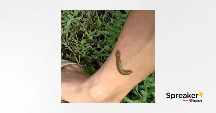 Nằm Mơ Thấy Đỉa Cắn Chân: Ý Nghĩa Và Phân Tích Chi Tiết