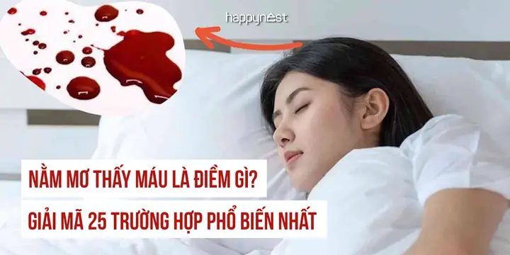 Nằm Mơ Thấy Máu Ở Tay: Ý Nghĩa Khoa Học, Tâm Lý Và Cách Ứng Phó