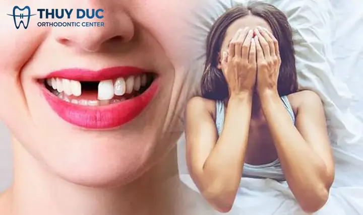 Phong Thủy Mơ Thấy Rụng Răng: Ý Nghĩa Và Giải Thích Khoa Học